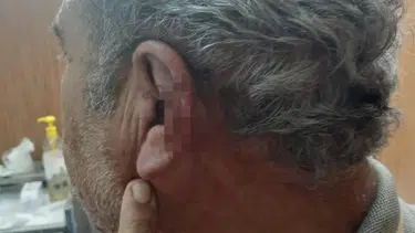Aile hekimi ile emekli öğretmenin mesai kavgası karakolda bitti