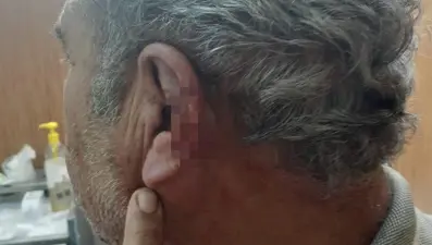 Aile hekimi ile emekli öğretmenin mesai kavgası karakolda bitti