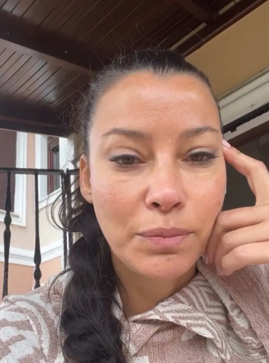 Müjde Uzman'dan burun estetiği yorumlarına videolu yanıt 2