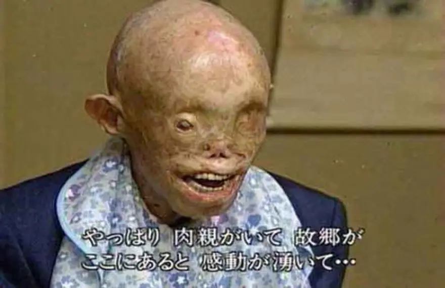 Hiroşima gazileri : ‘HIBAKUSHA’ 21 Hiroşima gazileri : ‘HIBAKUSHA’ 21