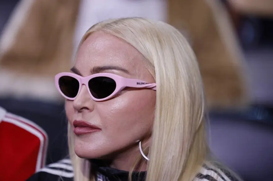 Madonna'nın köpek taklidi tepki topladı: İğrençsin! 5