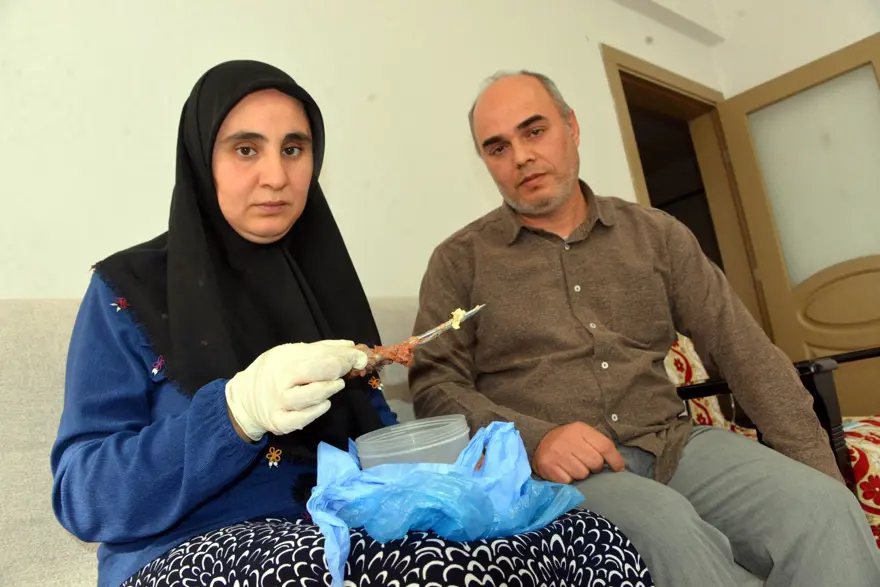 Karnında makas unutuldu,  7 yıl sonra böyle ortaya çıktı: "Mucize eseri hayatta kalmışım" 5