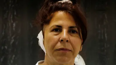 Ameliyat sırasında duymaya başladı