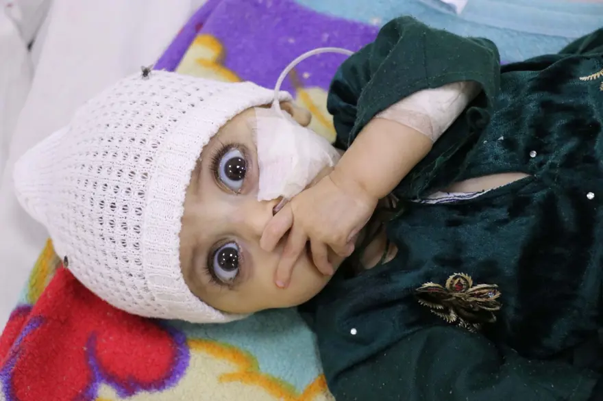 İnsanlık dramı: Sütten kesilen Afgan annelerin bebekleri büyüyemiyor 33 İnsanlık dramı: Sütten kesilen Afgan annelerin bebekleri büyüyemiyor 33