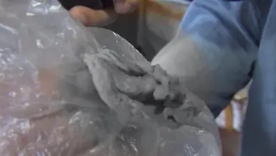 6 yaşındaki çocuğun boğazında gazlı bez unuttular