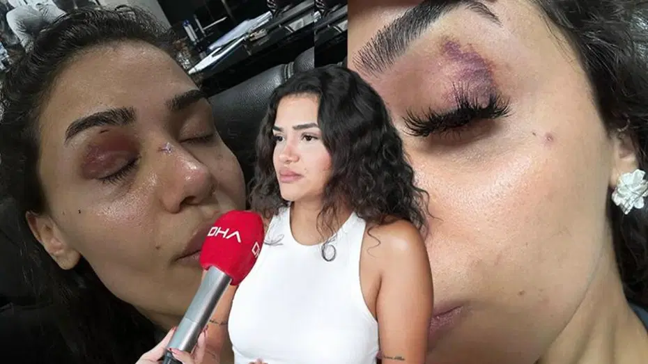 Ebru hemşirenin yardım çığlığı: 