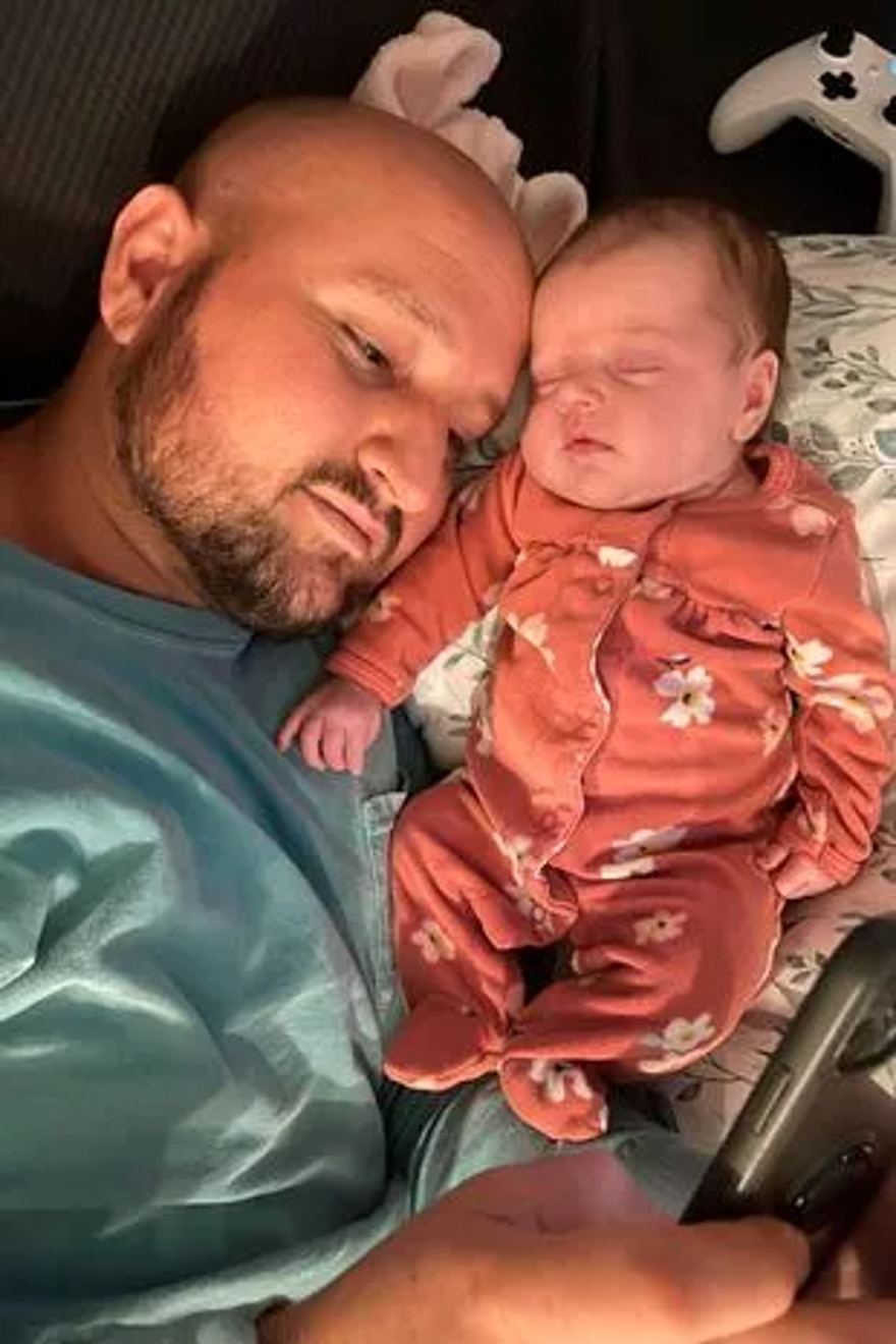 Milyonda 2 kişide görülüyor: Grip oldu, burnunu kaybetti 5