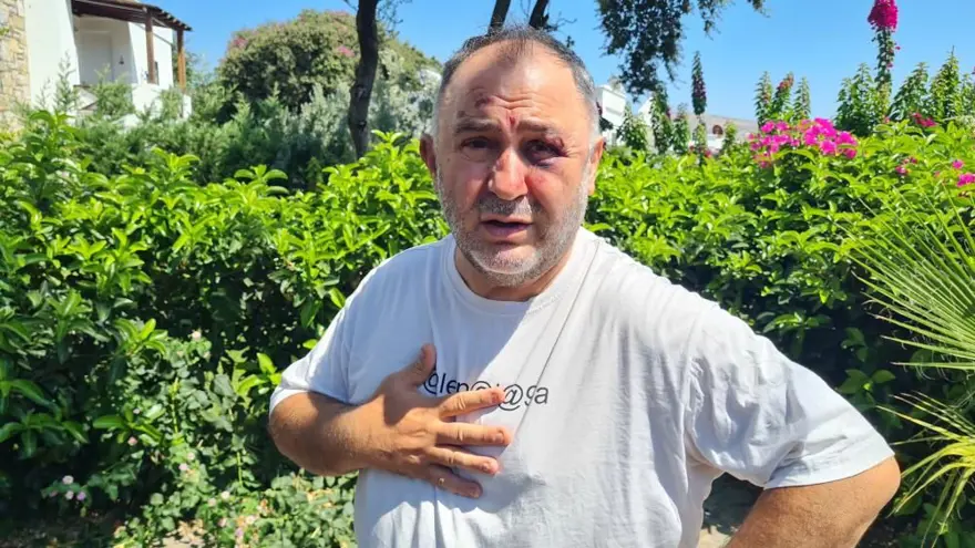 BİLİNCİNİ KAYBETTİ 1