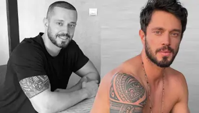 Murat Boz saç ektirdi