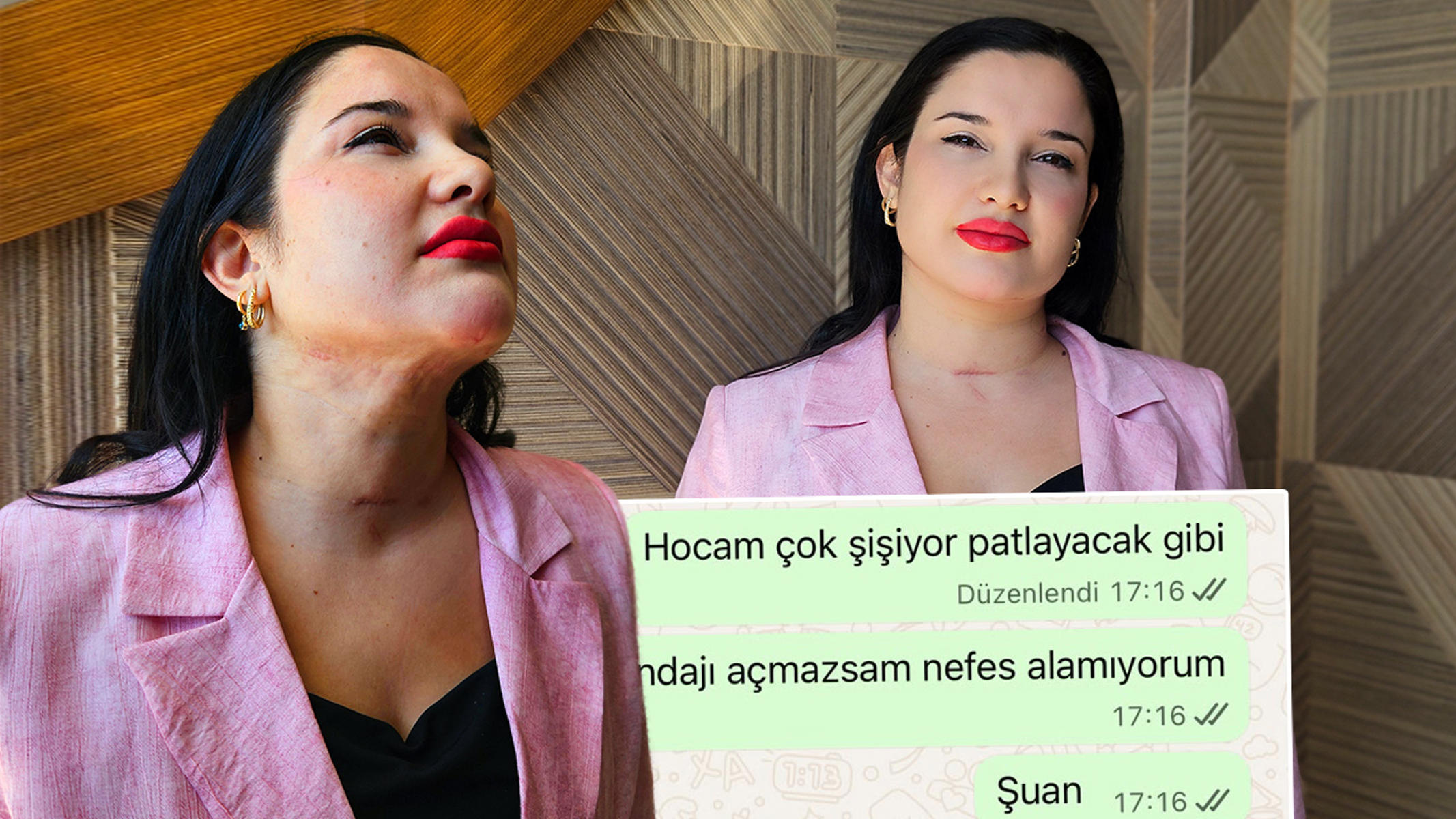 Estetik sonrası ölümden döndü, 5 milyon lira tazminat istedi. "Hocam patlayacak gibi"