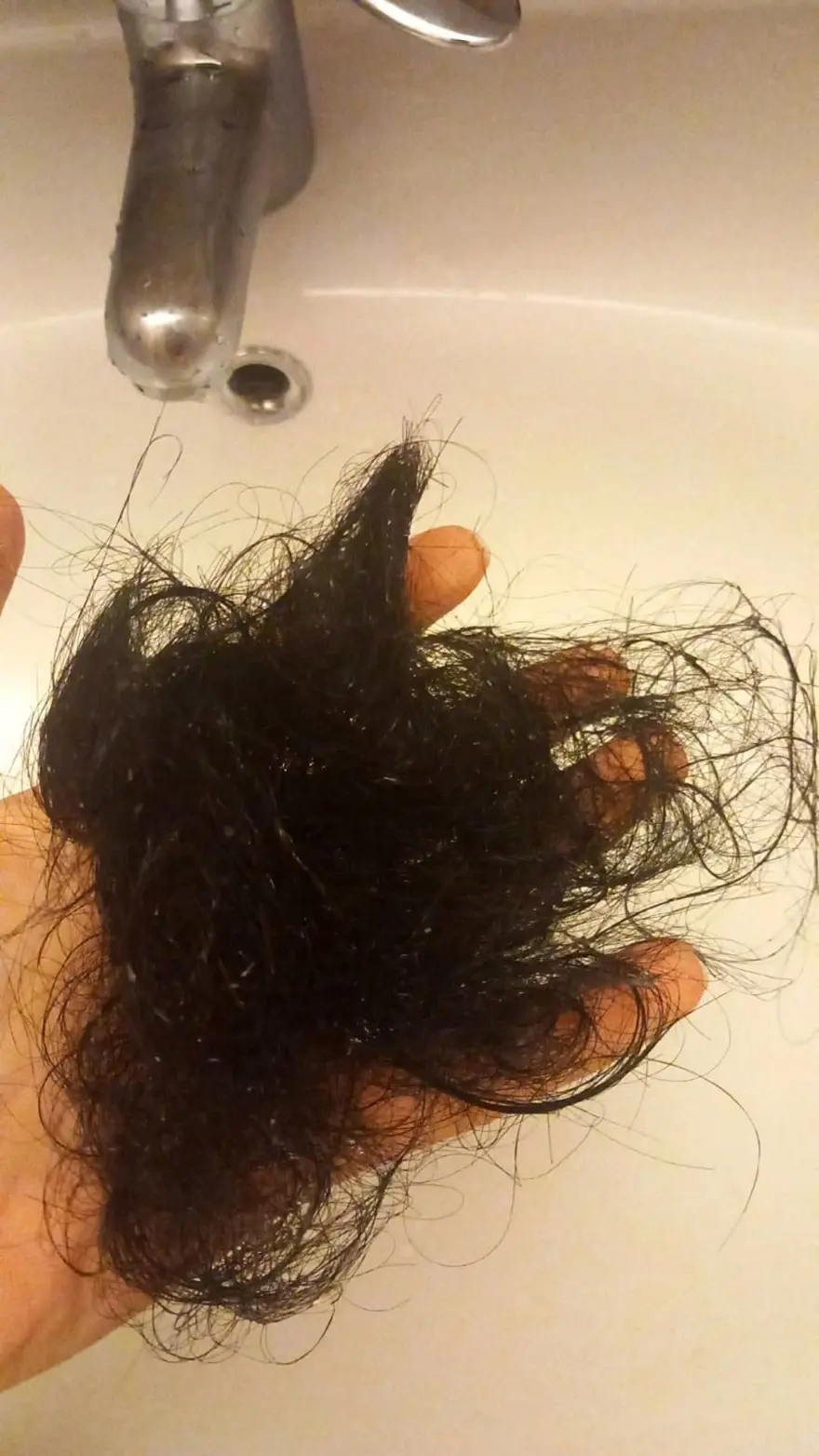 Ameliyatta karnında unuttukları iğne kabusu oldu! Eşi, bebek sahibi olamadığı için dövdü 4