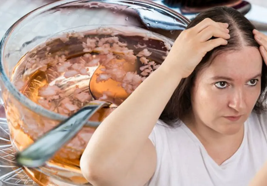 Kafasına sürenin 1 gecede saçı 2 kat çoğalıyor! Evde hazırlanan masrafsız saç çoğaltıcı kür 