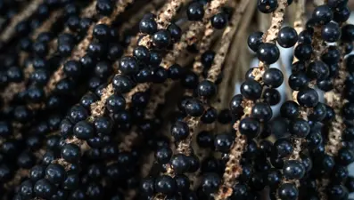 Böbrek sağlığı: Büyük fark yaratan 5 basit yaşam tarzı değişikliği