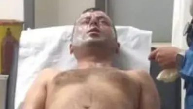 Tıkalı lavaboyu açmak isterken hastanelik oldu