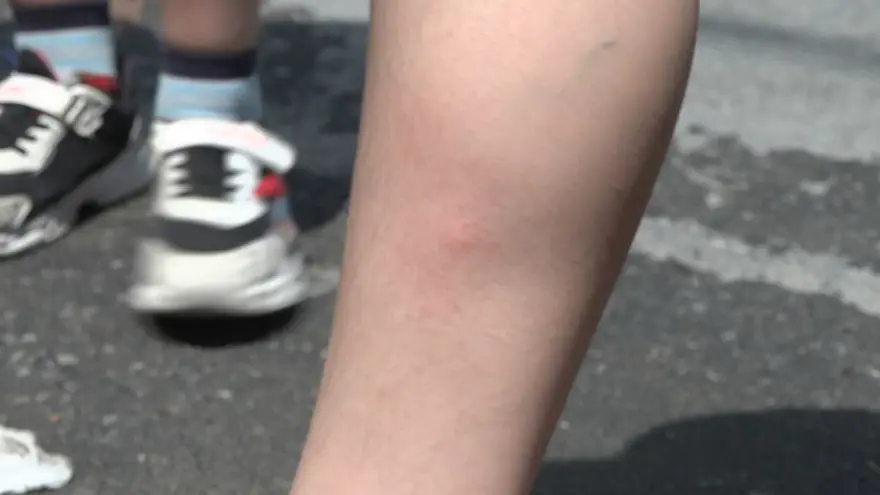 İstanbul'da "sivrisinek" tedirginliği 4