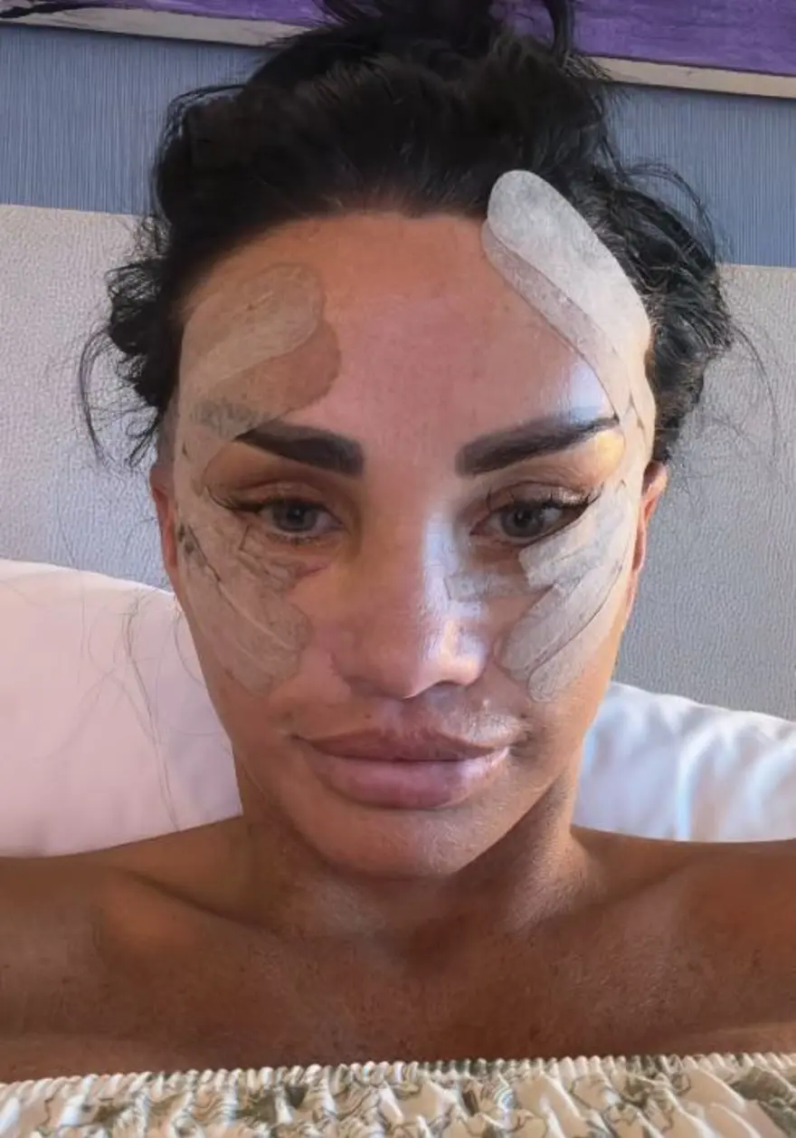 Defalarca yüzünü gerdiren Katie Price'ın son haline yorum yağdı! 'Estetik yaptırmadan duramıyorum' demişti 