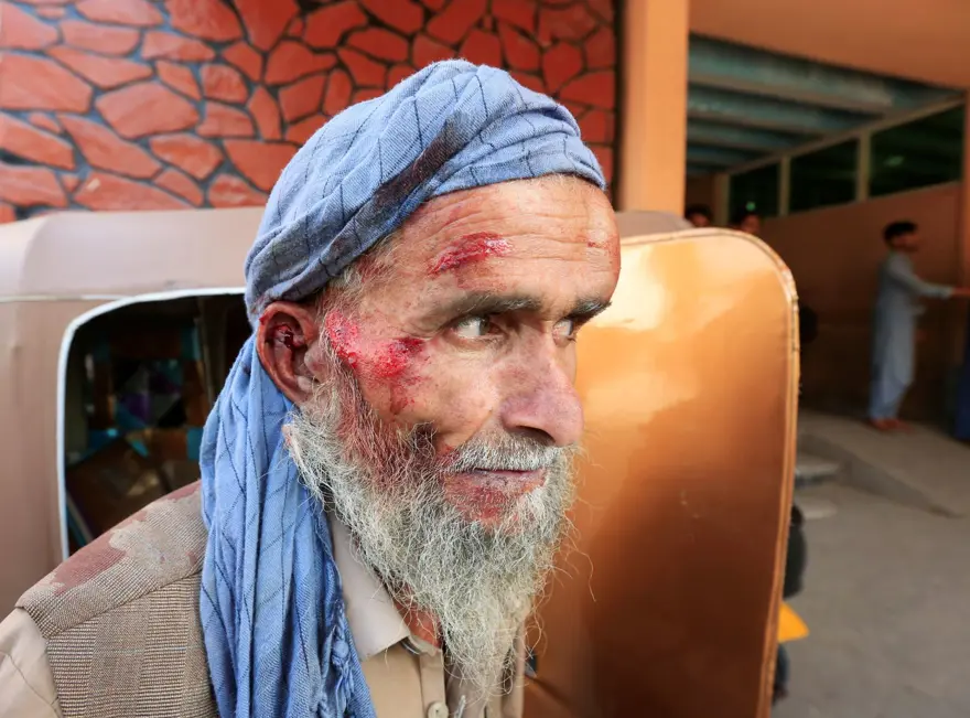 Afganistan'da Pakistan Konsolosluğu önünde izdiham: 15 ölü, 12 yaralı 3