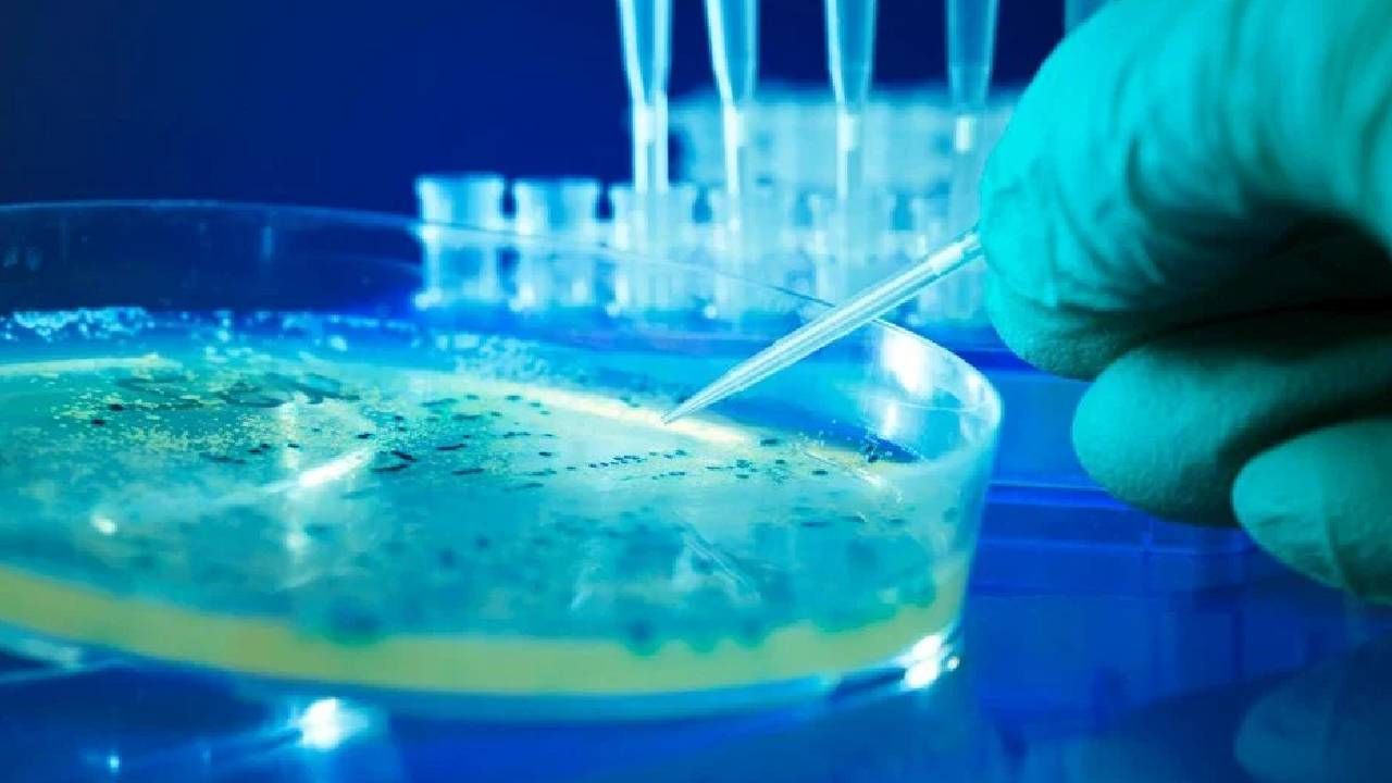 ABD’de salmonella alarmı