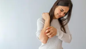 Sedef hastalığı dünyada 125 milyon insanı etkiliyor (Psoriasis neden olur?) Sedef hastalığı dünyada 125 milyon insanı etkiliyor (Psoriasis neden olur?)