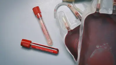 Kan merkezlerine corona virüs güncellemesi