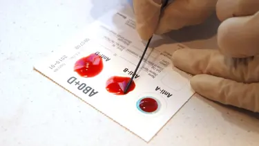 Kan grupları ile Covid-19’tan ağır hastalanma ya da ölüm riski arasında hiçbir bağlantı yok