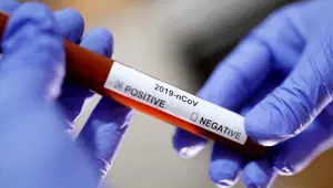 Corona virüsünün insan hücrelerine yayılmasını sağlayan proteinin yapısı çözüldü(Corona virüsünde son durum)