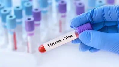 ABD'de şarküteri ürününden "listeria" bakterisi bulaşan 9 kişi zehirlenerek öldü