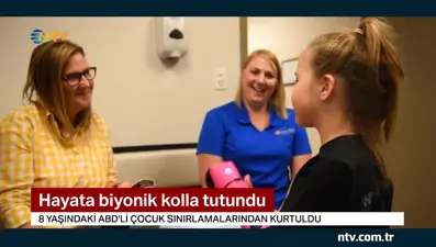 Hayata biyonik kolla tutundu