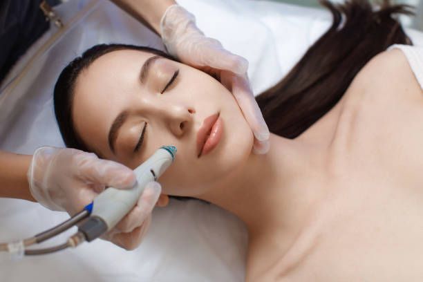 Hirsutizm nedir? Aşırı tüylenme (hirsutizm) belirtileri nelerdir? Nasıl tedavi edilir?
