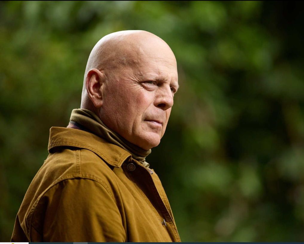Bruce Willis'in hastalığı afazi (söz yitimi) nedir, belirtileri neler?