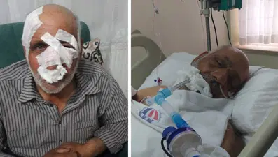 Köpek saldırısında yaralandı: Günlerdir yaşam savaşı veriyor