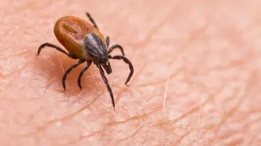 Hayalet hastalık Lyme: Keneden bulaşıyor, 300 hastalığı tetikliyor!
