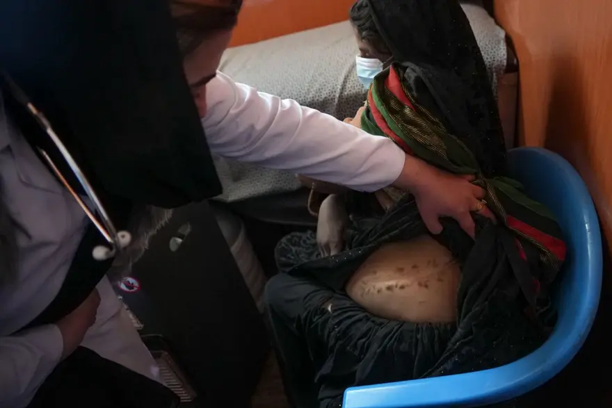 Afganistan'ın organ pazarı haline gelen kenar mahalleleri: 6 ve 8 yaşındaki iki kızımın ardından böbreğimi sattım 17