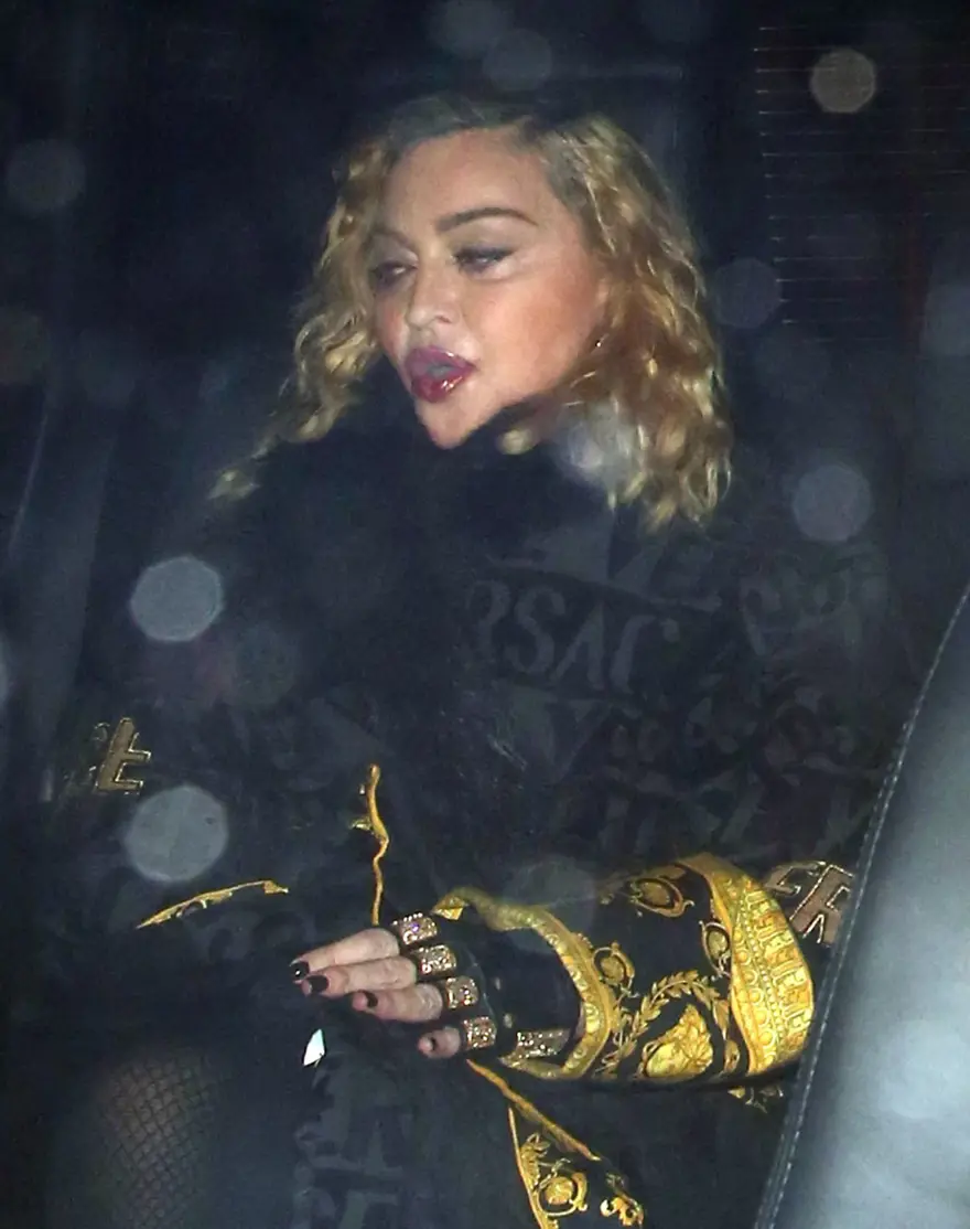 Madonna’nın son hali (Hastalık mı estetik mi?) 1