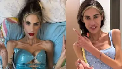 25 kiloya kadar düşen Nihal Candan hayatını kaybetti