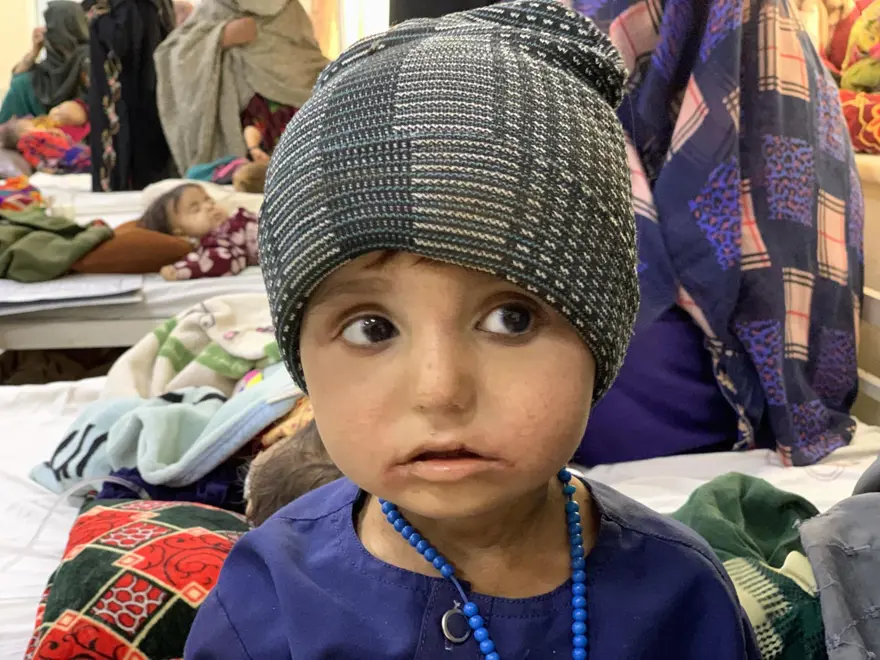 İnsanlık dramı: Sütten kesilen Afgan annelerin bebekleri büyüyemiyor İnsanlık dramı: Sütten kesilen Afgan annelerin bebekleri büyüyemiyor