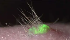 Yapay deri naklinde önemli gelişme Yapay deri naklinde önemli gelişme