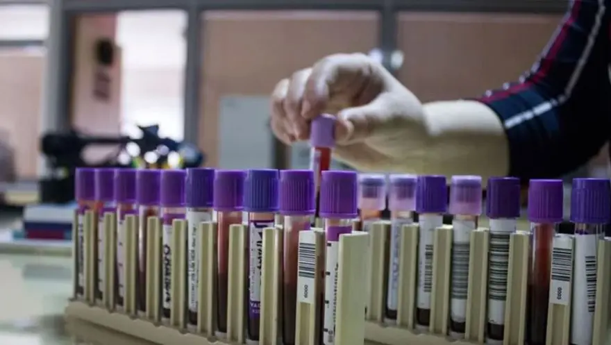 TALASEMİ BELİRTİLERİ 3