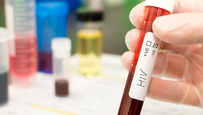 HIV virüsünün daha zararlı ve bulaşıcı varyantı tespit edildi