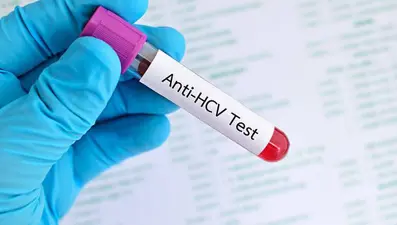 Anti HCV nedir?