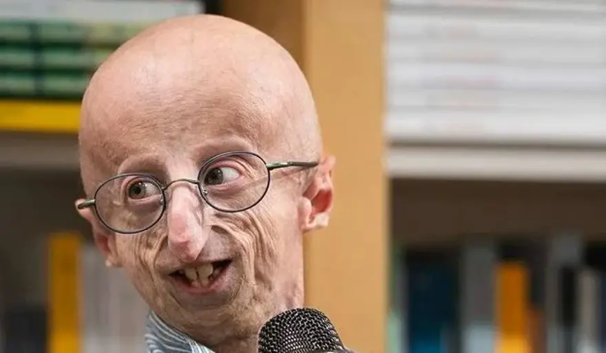 4 milyonda 1 görülüyor: Bu hastalığa yakalanan en fazla 20 yıl hayatta kalabiliyor 2 4 milyonda 1 görülüyor: Bu hastalığa yakalanan en fazla 20 yıl hayatta kalabiliyor 2