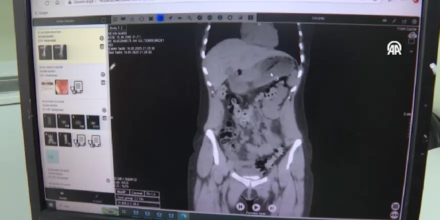 Zayıflamak isterken diş fırçası yuttu! 2