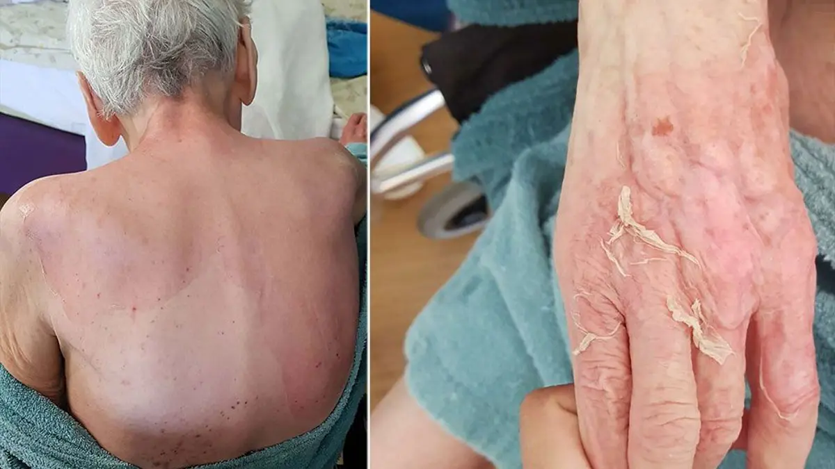 Huzurevinde banyo sonrası ölüm. Doktora 6 taksitli 21 bin lira ceza