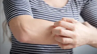 Sivrisinekler bazı insanları mıknatıs gibi buluyor. "Beni hep ısırıyorlar" diyorsanız nedeni buymuş