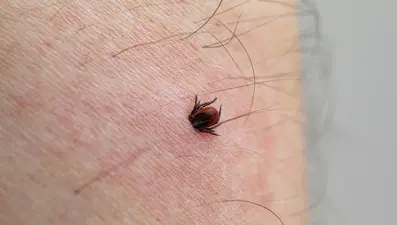Kenelerden korunmak için 4 doğal yöntem