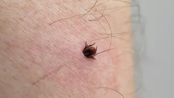 Kenelerden korunmak için 4 doğal yöntem