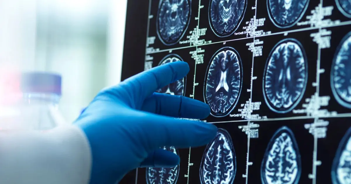 8 yıllık araştırma sonuçlandı. İşte demans riskini yüzde 40 azaltan aktivite