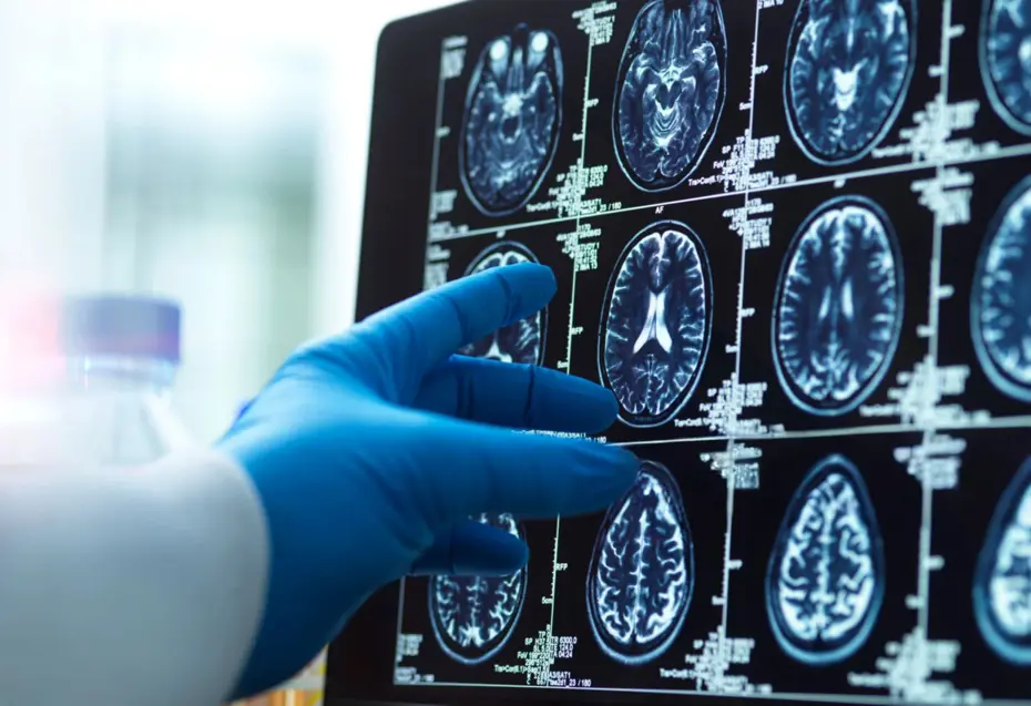 8 yıllık araştırma sonuçlandı. İşte demans riskini yüzde 40 azaltan aktivite