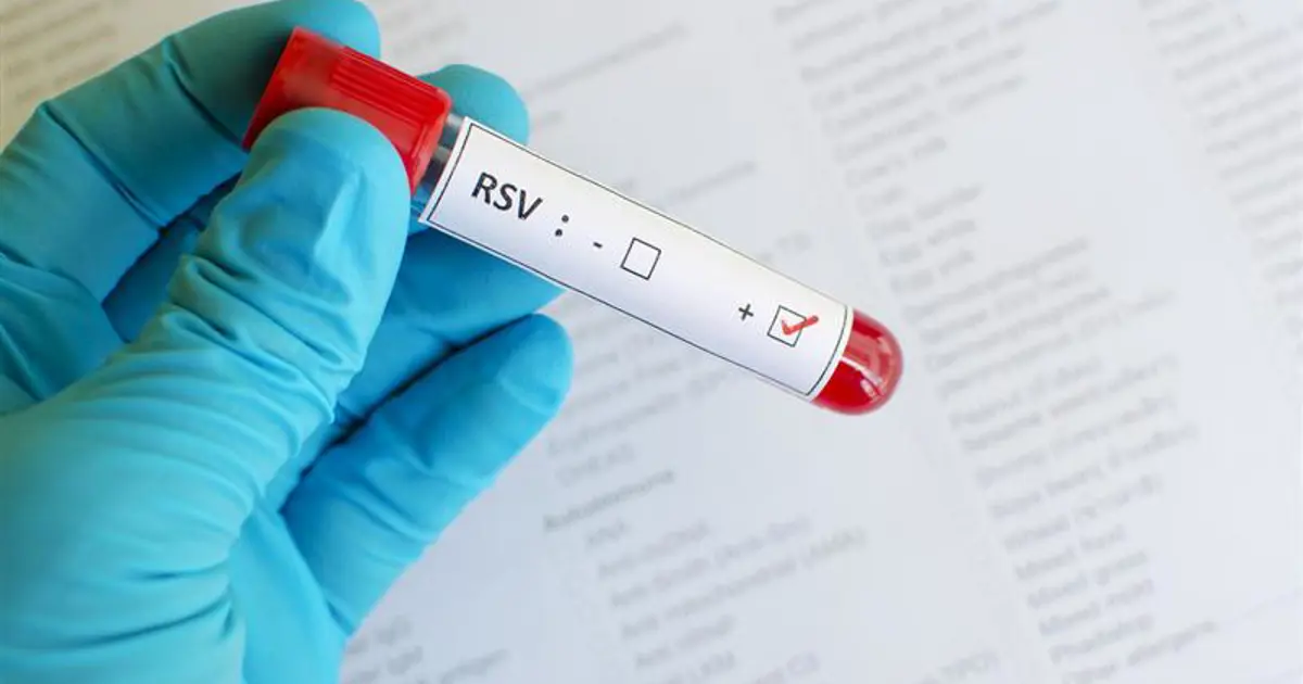 Hedefinde çocuklar var. Damlacık yoluyla bulaşıyor ciğere yerleşiyor, ölüme bile götürüyor