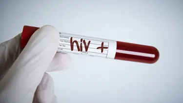 Eşinden HIV pozitif olduğunu saklayan adama hapis cezası
